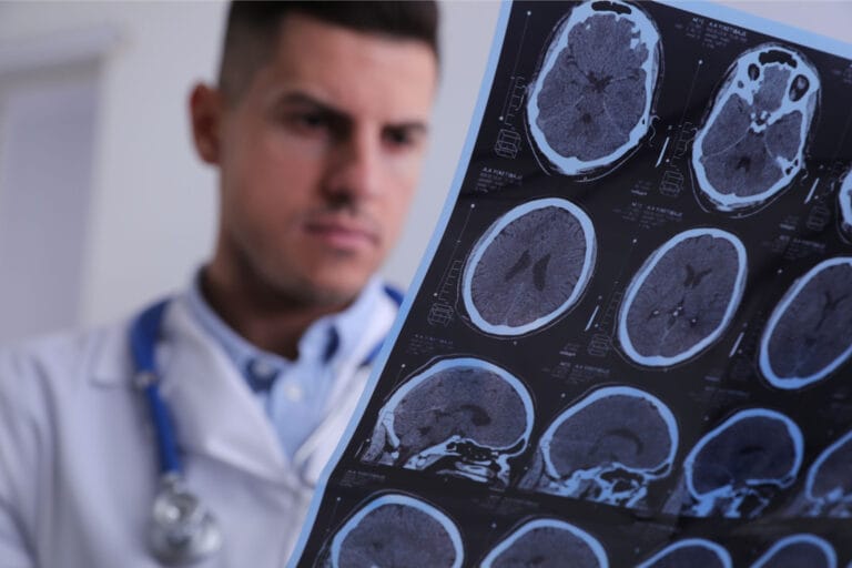 Estudo relaciona distúrbios do sono a alterações cerebrais