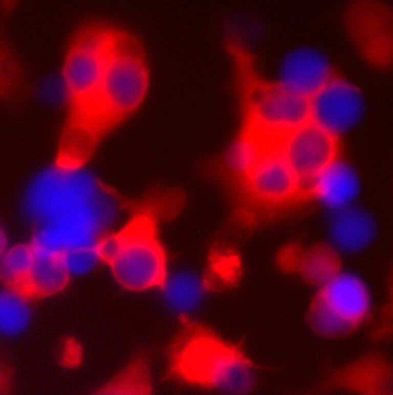 Cientistas da USC desenvolvem células imunológicas contra câncer