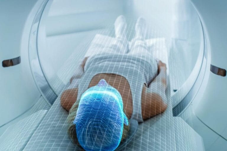 PSMA PET Scan revela câncer de próstata oculto em 56% dos pacientes