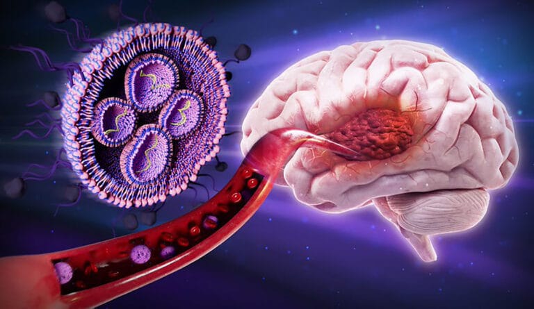 Universidade de Oregon desenvolve tratamento para glioblastoma