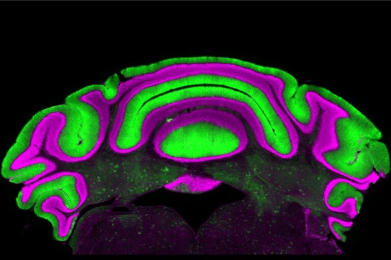 Estudo revela desconexão em células cerebelares relacionadas a distúrbios de movimento