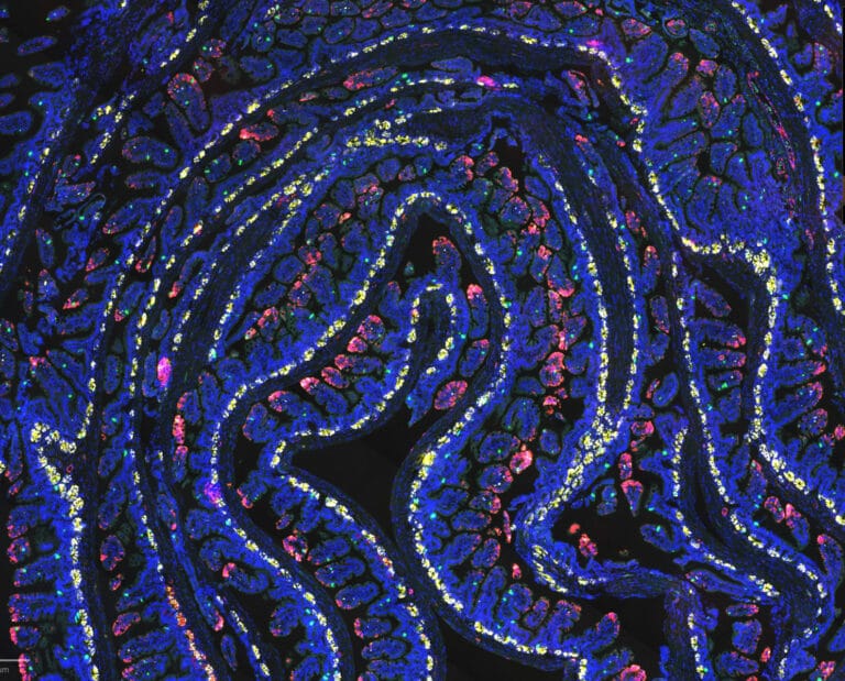 Estudo revela que jejum ativa bactéria essencial para recuperação intestinal