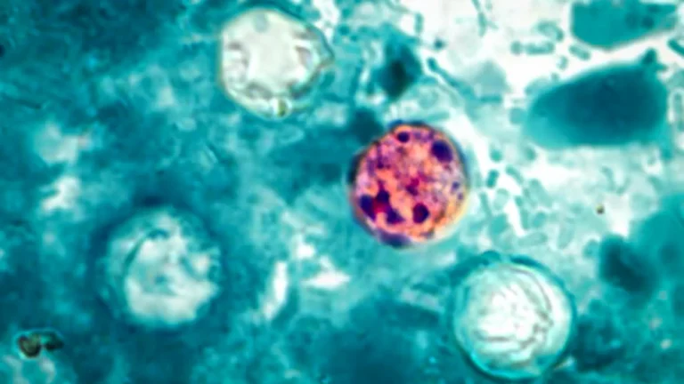 CDC investiga surto de Cyclospora com mais de 400 casos