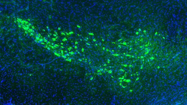 Pesquisadores da Yale identificam proteínas que espalham Parkinson
