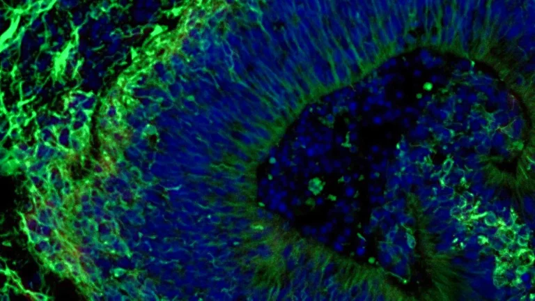 Organoides cerebrais podem prever tratamentos para Alzheimer