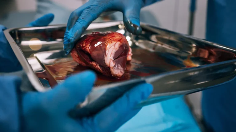 Estudo revela que quase metade de pacientes não inicia avaliação para transplante renal