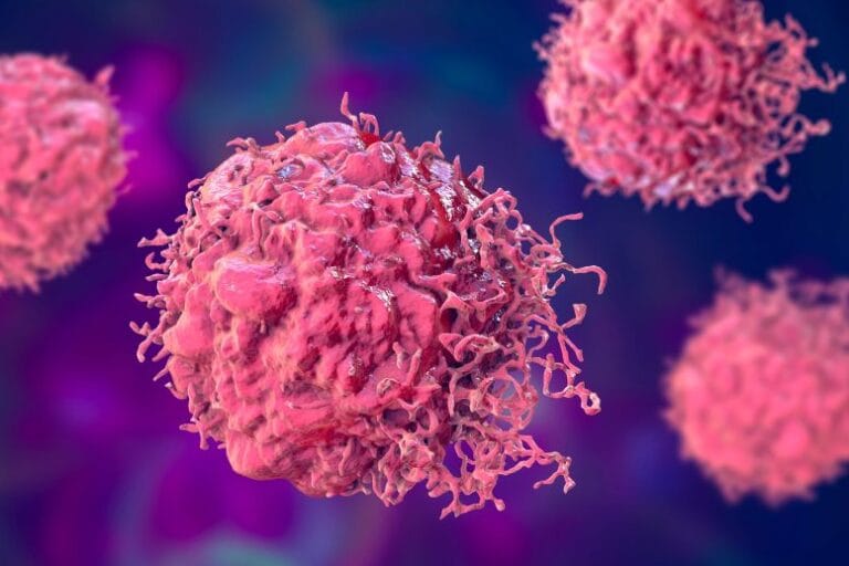 Universidade de Minnesota revela nova estratégia contra câncer pancreático