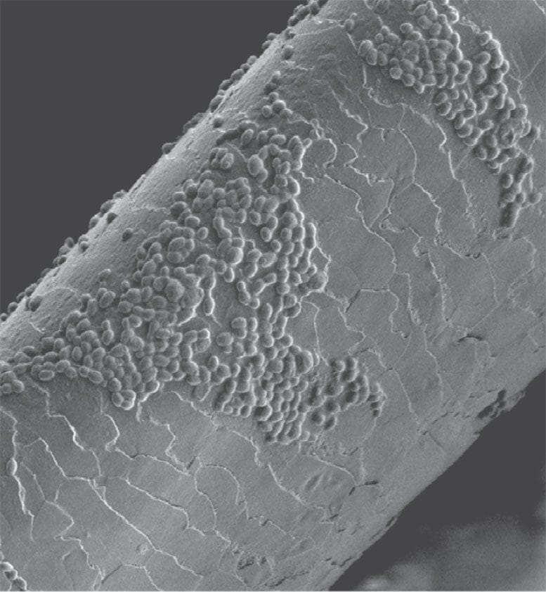 Candida auris Spores on an Infected Hair Follicle