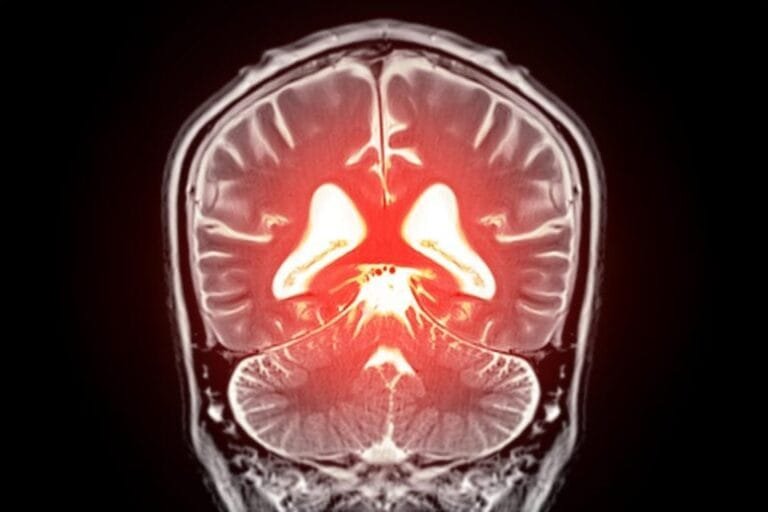 Estudo relaciona conexões cerebrais à preservação cognitiva em idosos