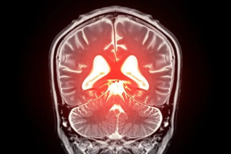 Estudo relaciona conexões cerebrais à preservação cognitiva em idosos