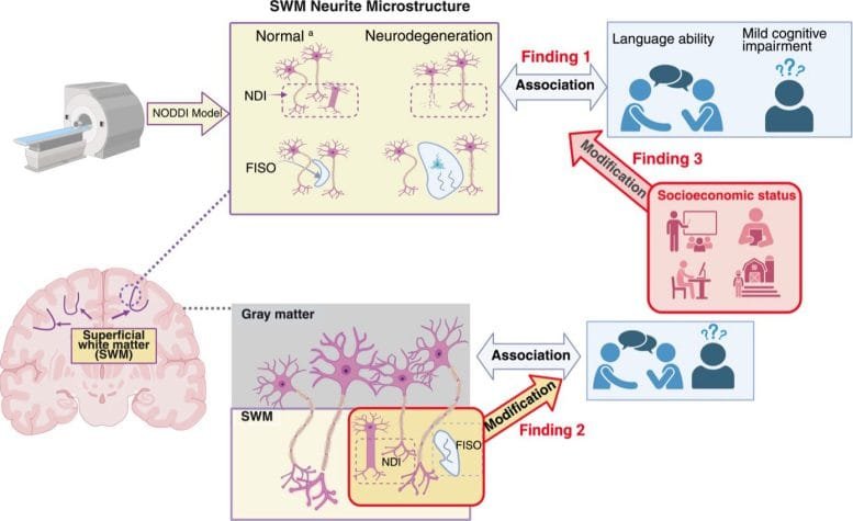 Diagram of Brain Microstructure