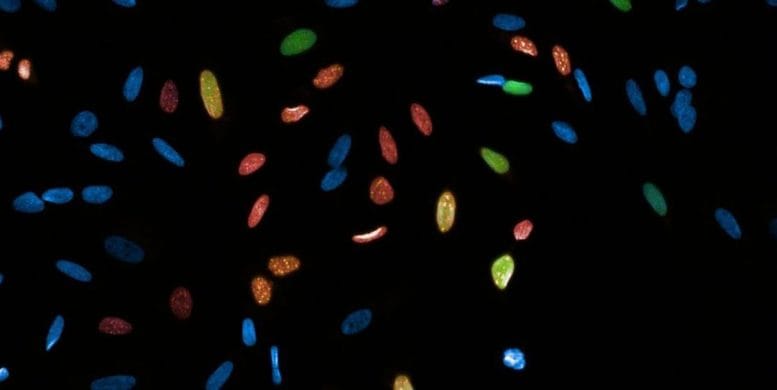 Fluorescent Cancer Cell Nuclei