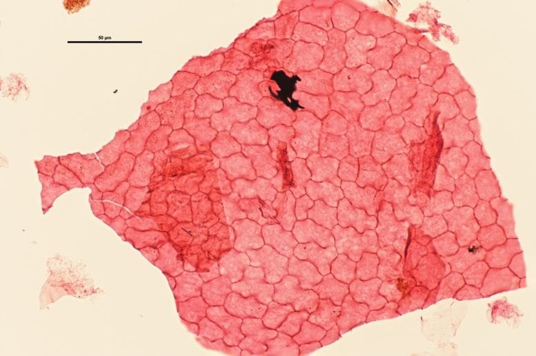 Fossilized Leaf Cuticle From Dense Forest
