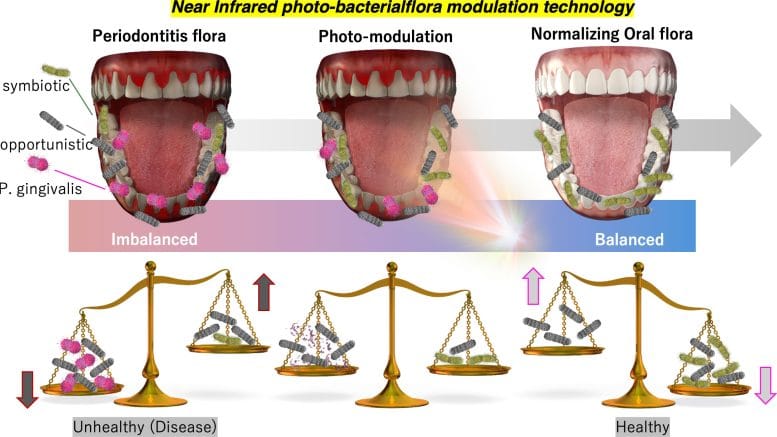 Graphic of Near Infrared Gum Bacteria Targeting