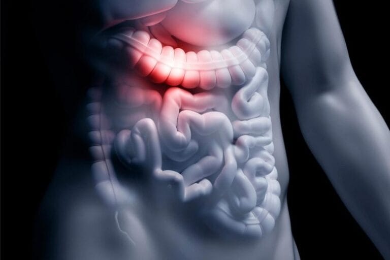 Estudo relaciona composto de bactérias intestinais ao Alzheimer