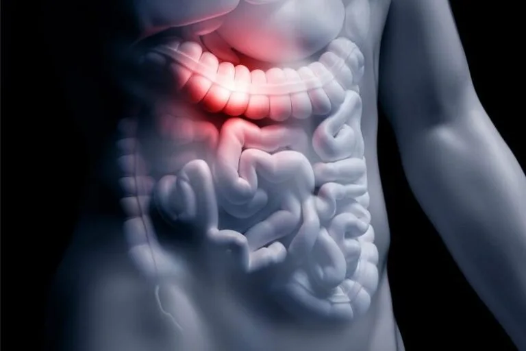 Estudo relaciona composto de bactérias intestinais ao Alzheimer