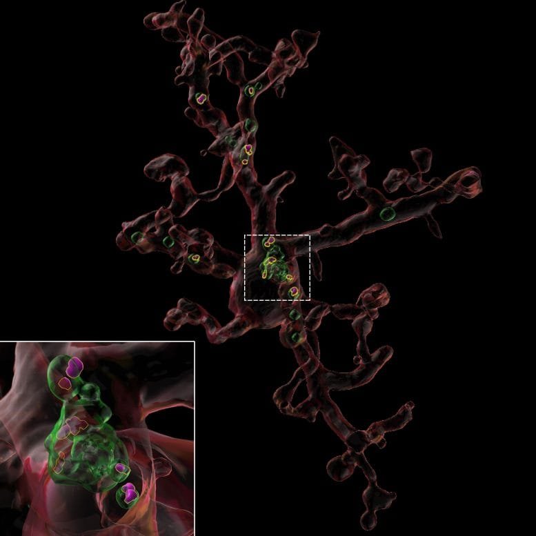 Image Reconstruction of Microglia From an Aged Mouse Treated With TIMP2