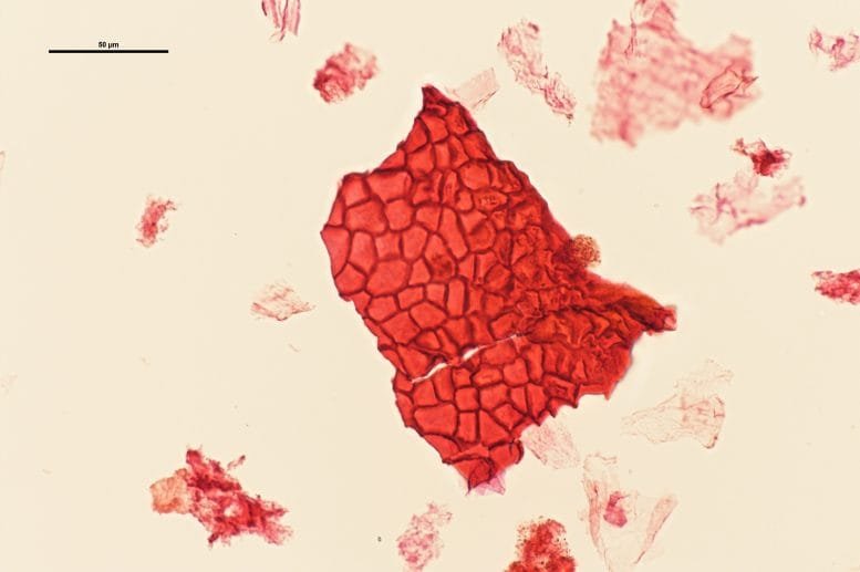 Leaf Cuticle From Sun Exposed Vegetation