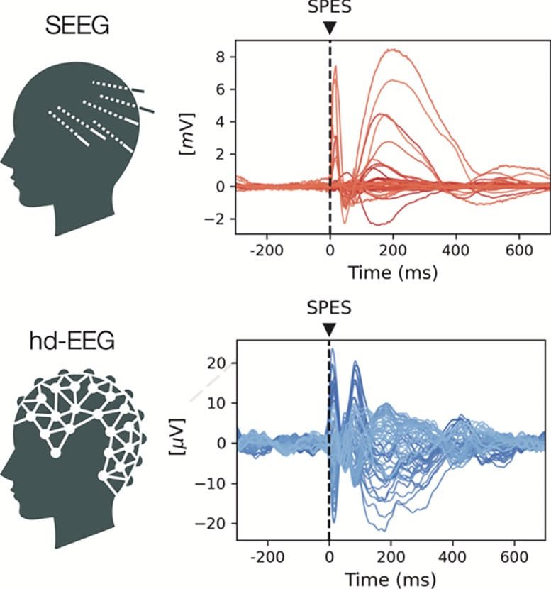 Measuring Brain Responses to Electrical Stimulation