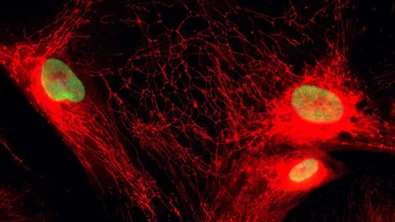 Mitochondrial Network and Histone Acetylation