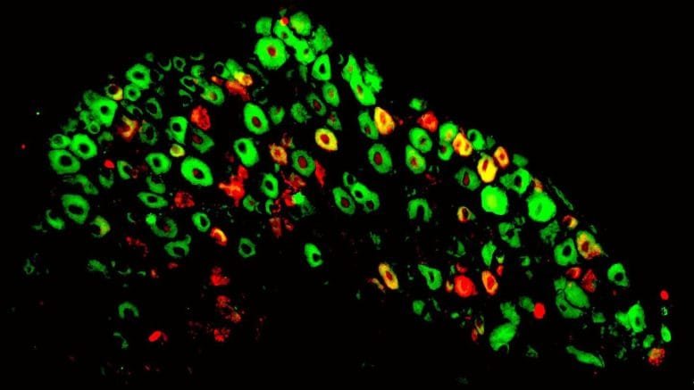 Sensory Neurons Labeled With BRAF and CGRP