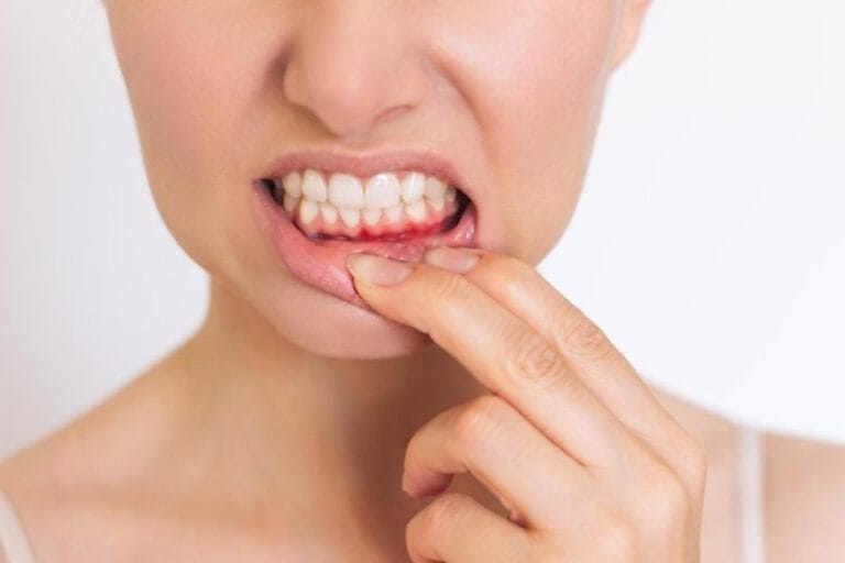 Universidade de Nagoya desenvolve terapia para periodontite