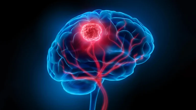 Nanopartículas inteligentes iluminam e tratam câncer cerebral