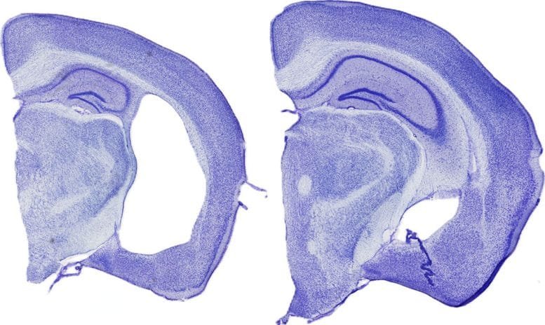 Alzheimer’s Brain Damage in Mice