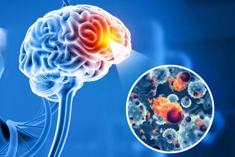 Cientistas encontram ligação entre células-tronco e tumores cerebrais infantis