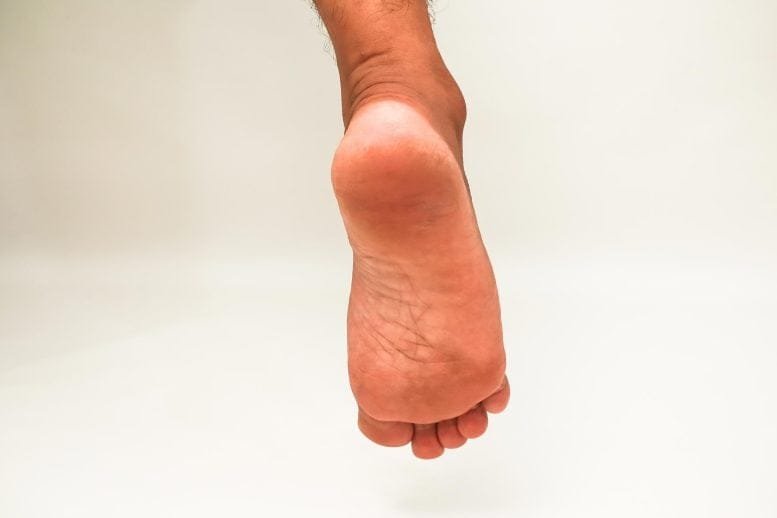 Close Up Man Foot Sole Toes