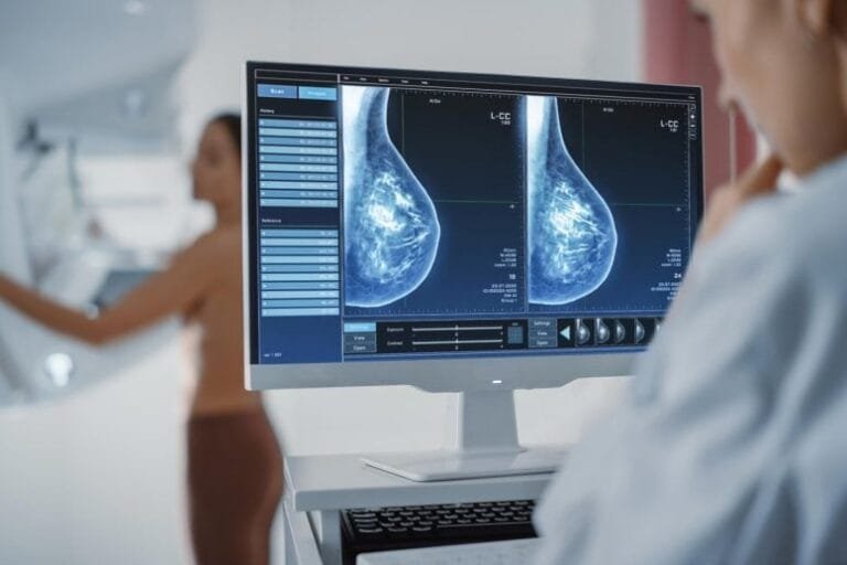 Estudo reavalia risco de superdiagnóstico em mamografias