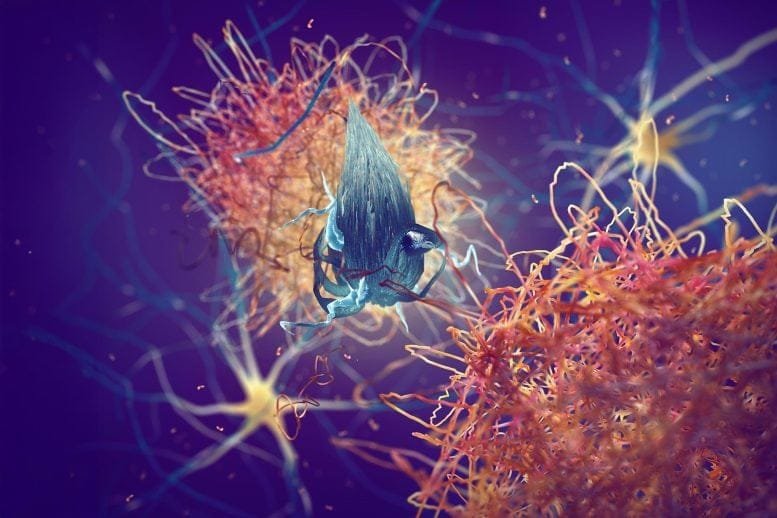Damaged Brain Nerve Cell Neuron Amyloid Plaques Alzheimer’s Dementia