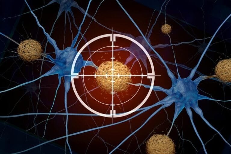 Proteína SORLA pode oferecer novo tratamento para Alzheimer