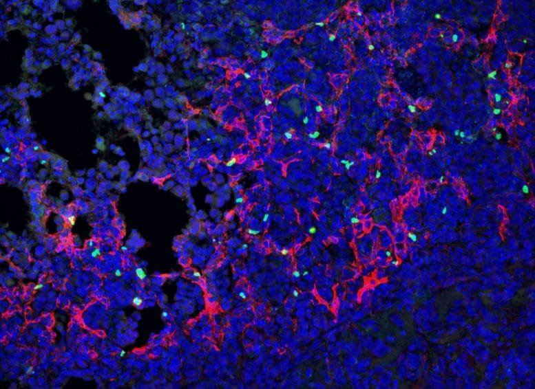 Fibroblasts and Regulatory T Cells in Lung Tumors