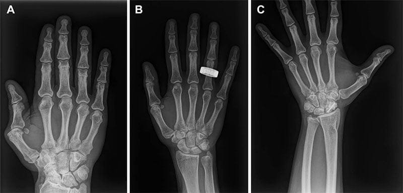 X-ray images obtained by Dr. Gifford and her team during the Fram2 commercial spaceflight. Credit: Gifford, S.A. et al. (2026)