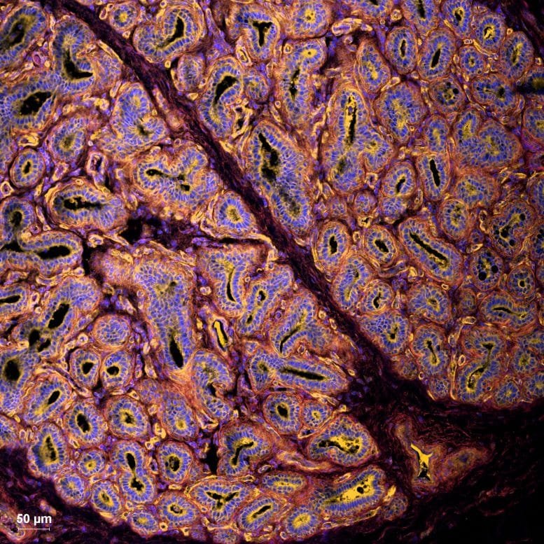 H5N1 Receptors in Bovine Mammary Tissue