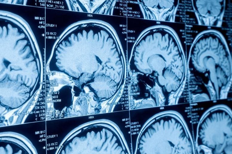 MRI Brain Scan Screen