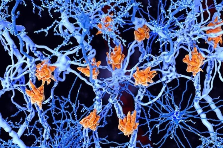 Droga experimental reverte paralisia em modelo de esclerose múltipla