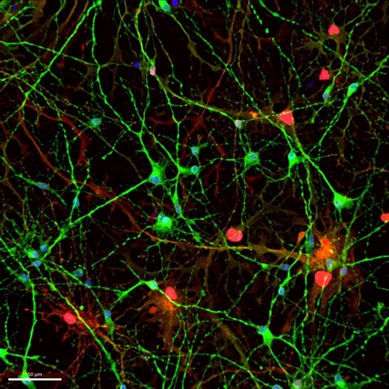 Neurons and Astrocytes Grown From Stem Cells