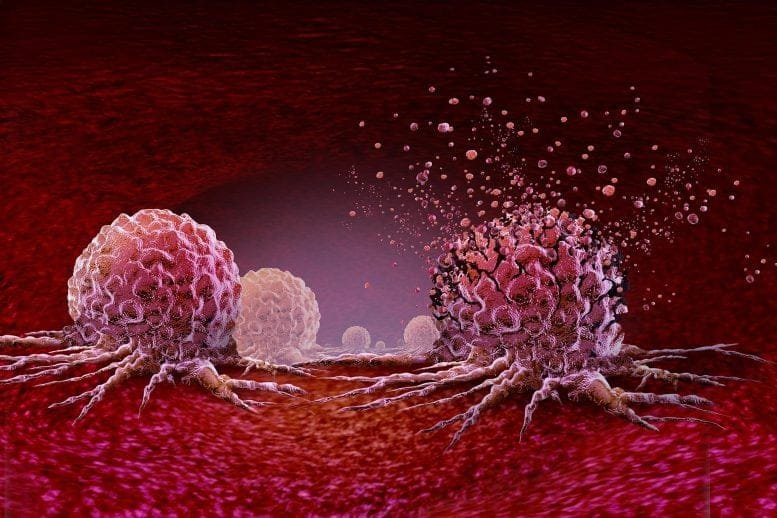 New Cancer Treatment Vibrating Malignant Cells
