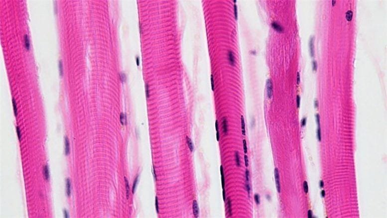 Pterostilbene Effects on Skeletal Muscle Cells