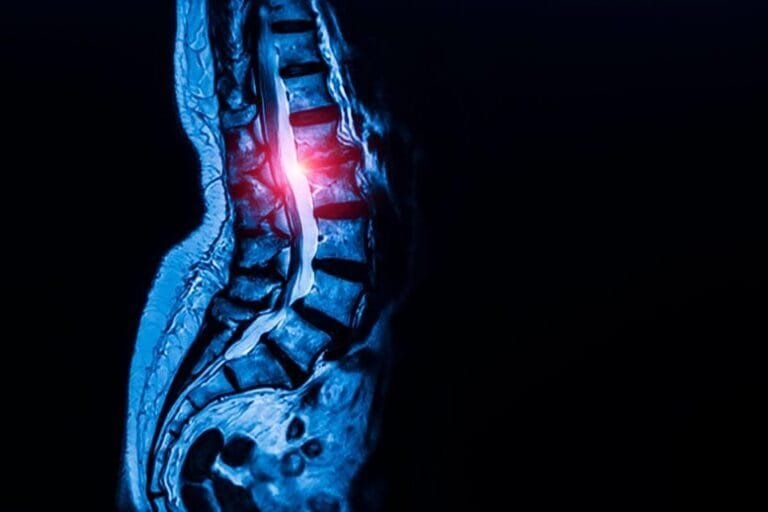 Células-tronco podem explicar crescimento de ligamentos na coluna