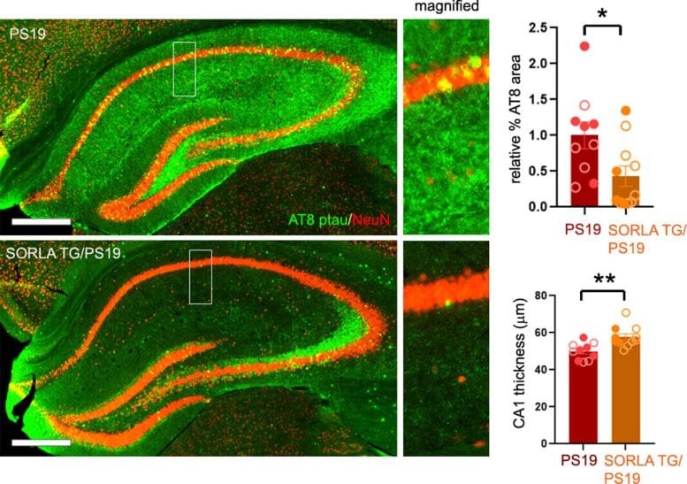 SORLA Reduces Phosphorylated Tau in Brain Tissue