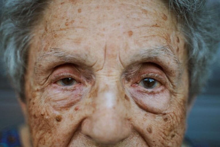Estudo revela desafios da regeneração neuronal em olhos envelhecidos