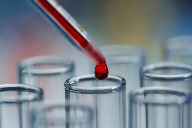 Teste de sangue identifica câncer pancreático em estágio inicial