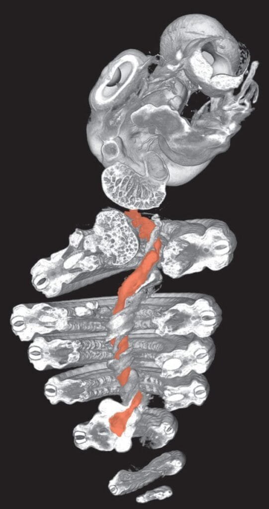Snake Embryo Visceral Pillar CT Scan