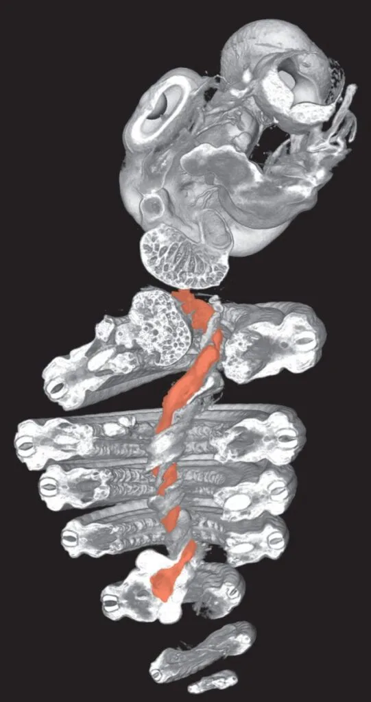 Snake Embryo Visceral Pillar CT Scan
