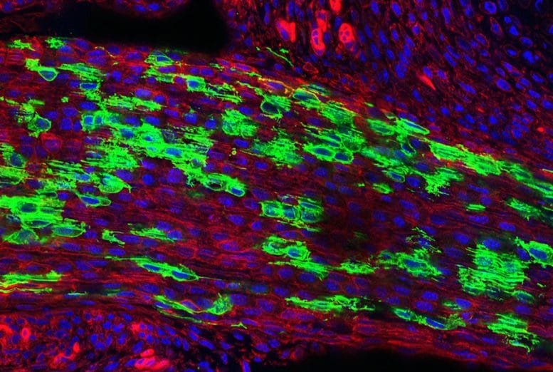 Tendon Stem Cells in Mouse Achilles Tendon