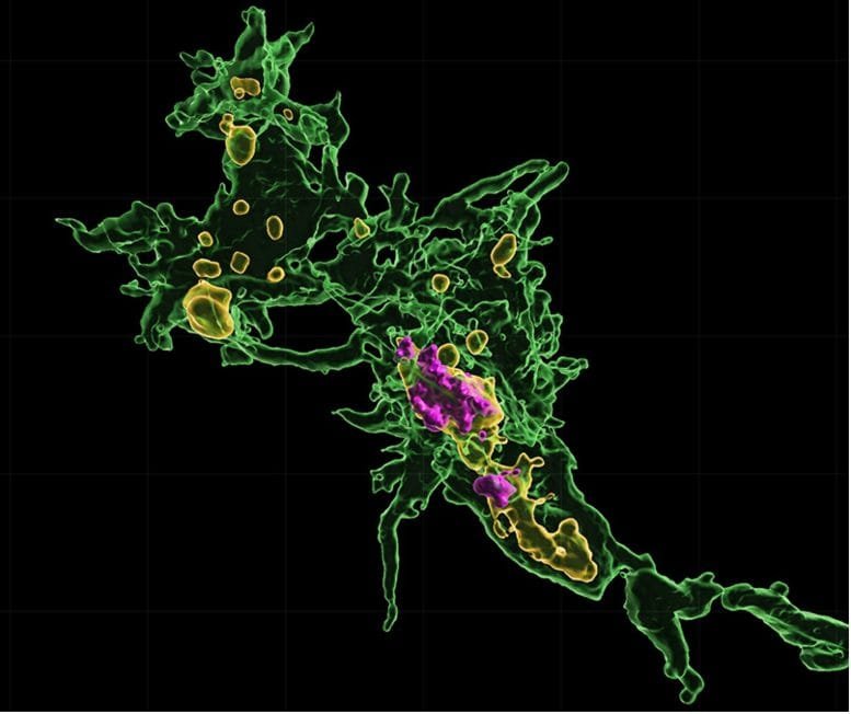 Visualization of Microglia After Eating Motor Neurons