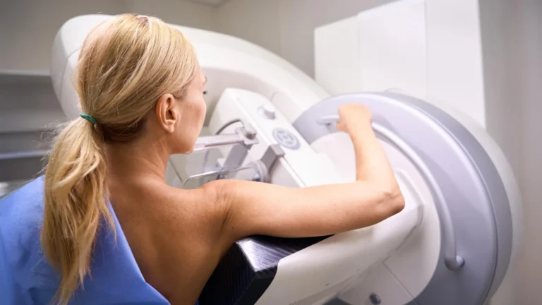 Estudo reduz estimativa de sobrediagnóstico em mamografias